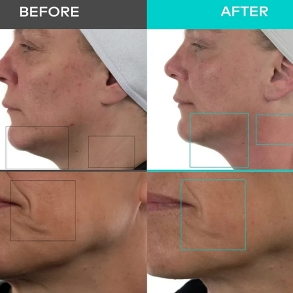 Nuovaluce Anti Aging Microcurrent  - Picture 5 of 5